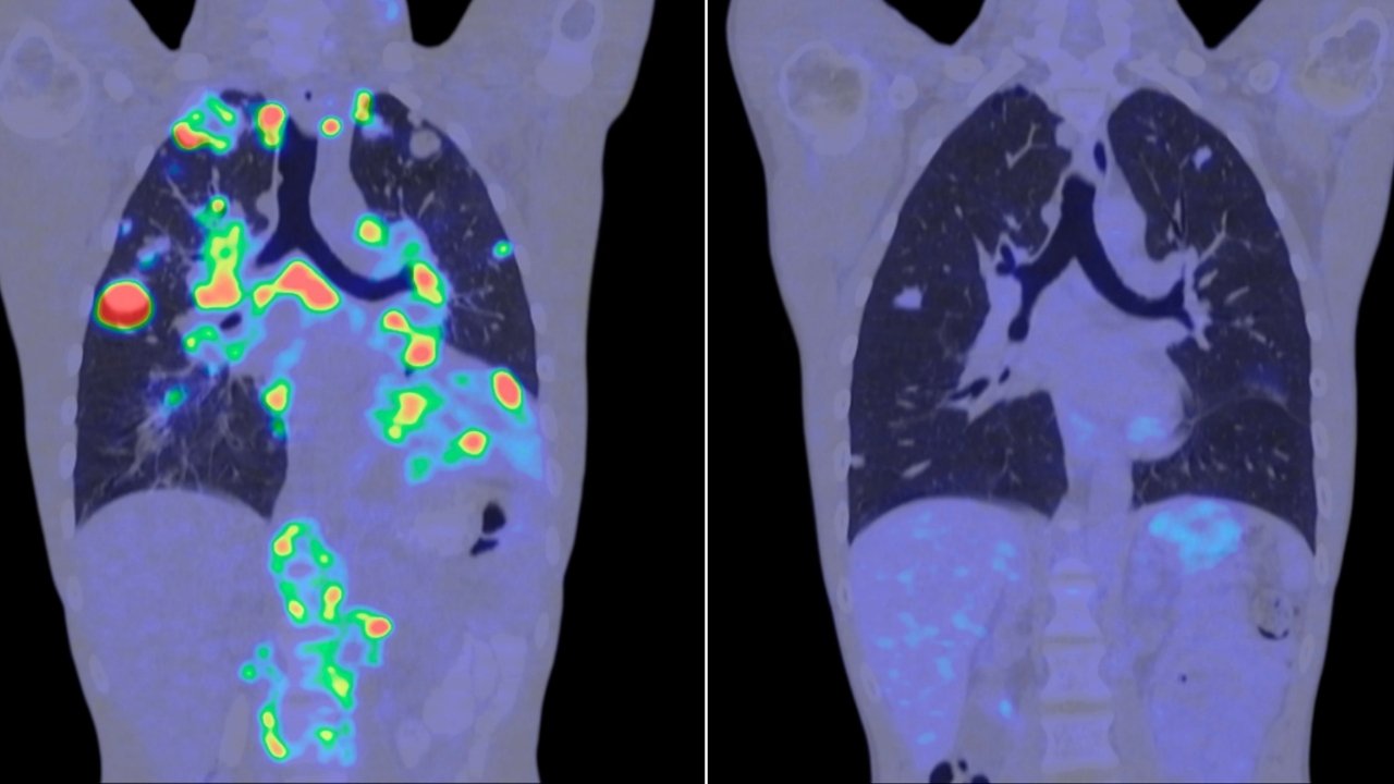 Görünmeyeni Gören Teknoloji