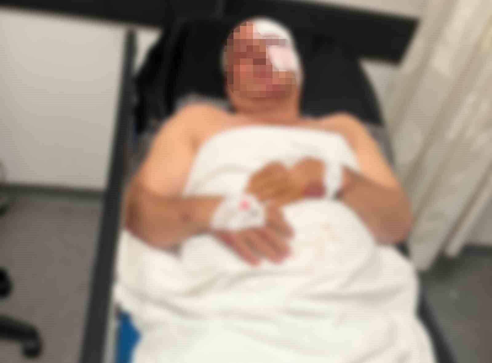Motosiklet Kazasinda Yaralandi Kardesinin Carptigini Iddia Etti 20260620 A W730179