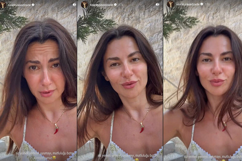 Nesrin Cavadzade Botoks Gondermesi Yuz Nakli Olmadan Onceki Halim Dedi 1780467507137