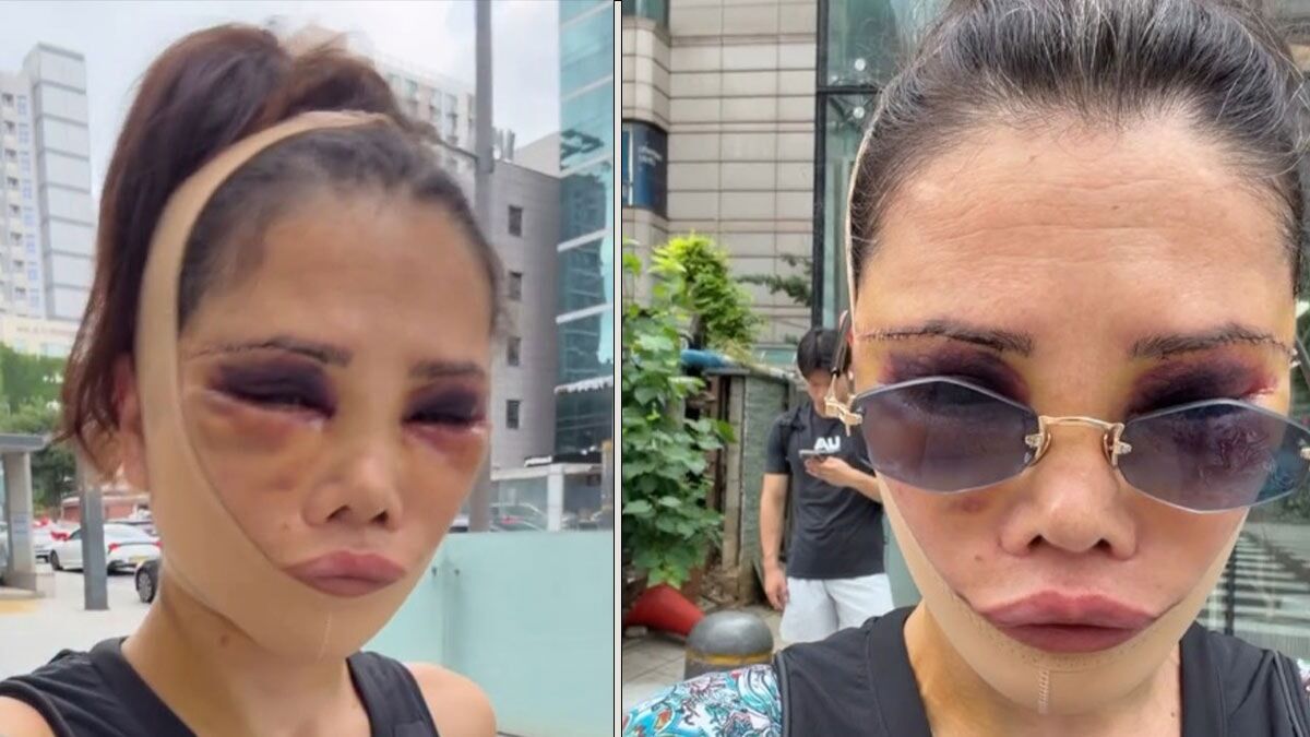 Didemceransonhalijpg 6 N D Q Sux0 Q7 1Q Rrw9 F A